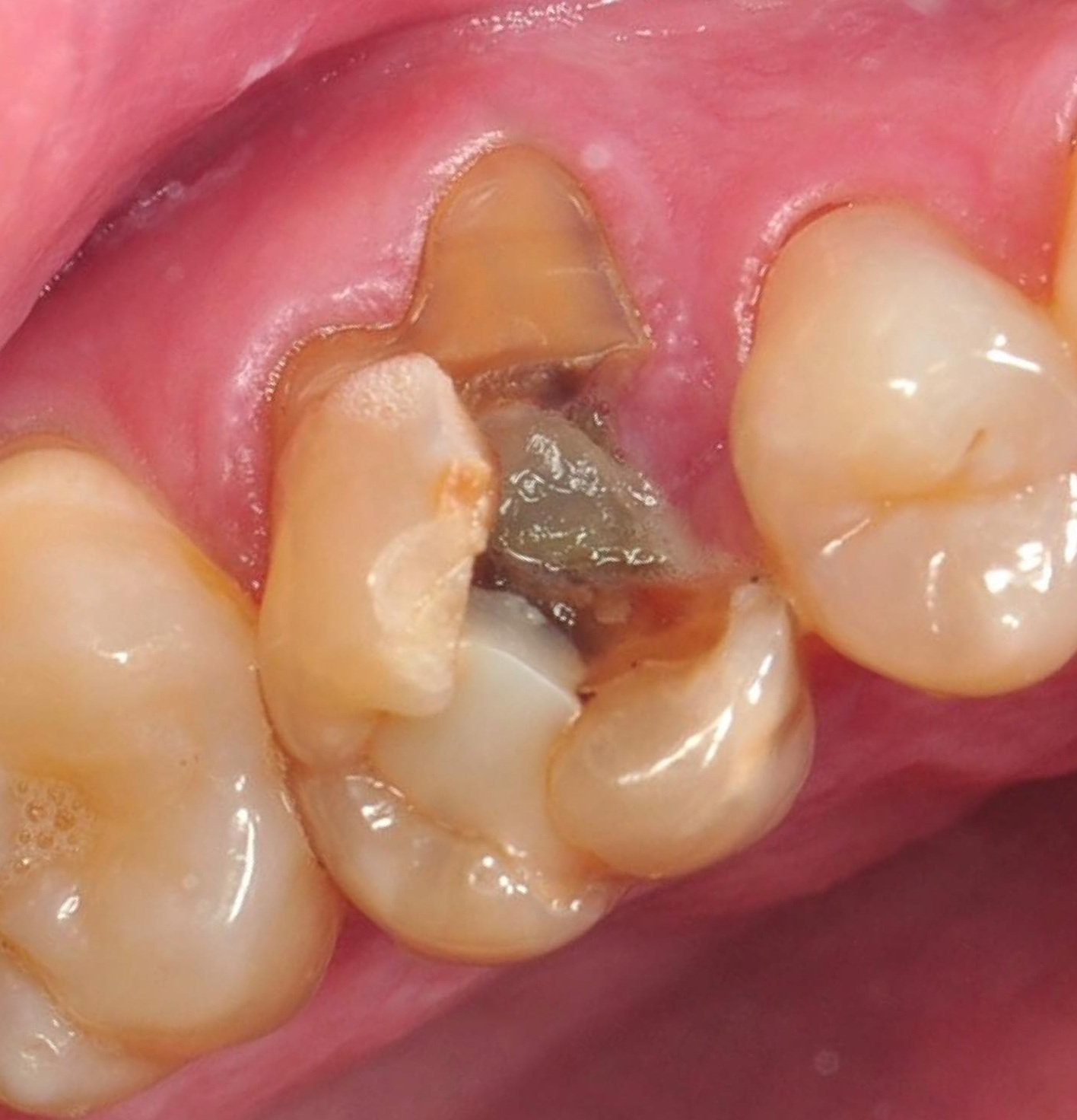 a large composite that has fractured and broken away